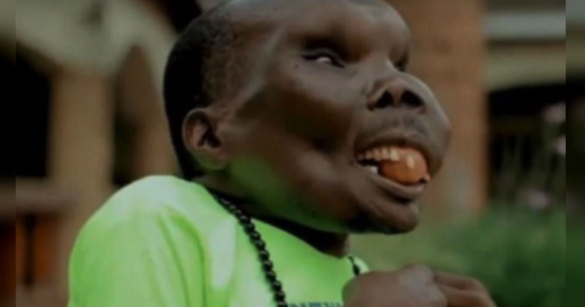 Inspiring Story of 'Uganda's Ugliest Man' Married + 8 Kids
