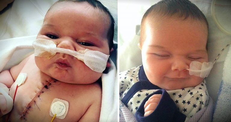 Miracle Baby Born With Half A Heart Survives Major Surgery At 4 Days Old