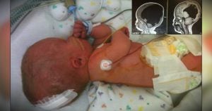 Miracle Boy Born With Virtually No Brain Function | Noah Wall Recovery