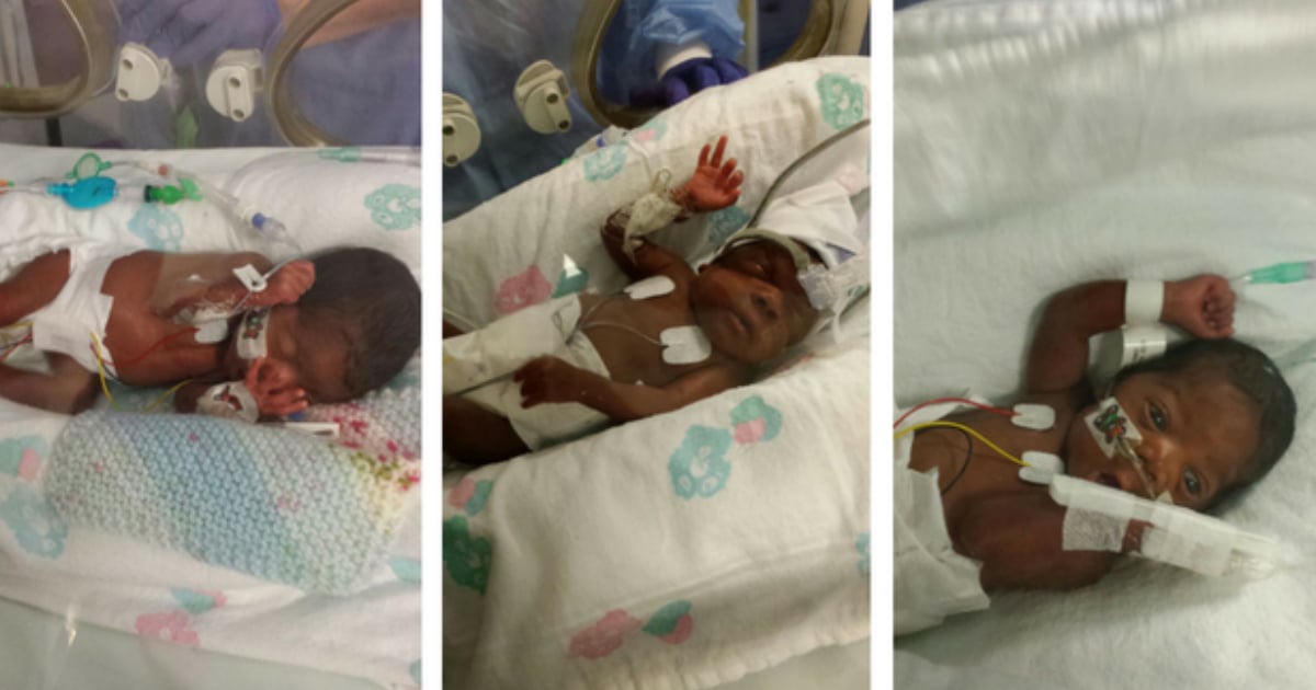 Miracle Triplets Survived Premature Birth & Severe Illness, Now Reunited