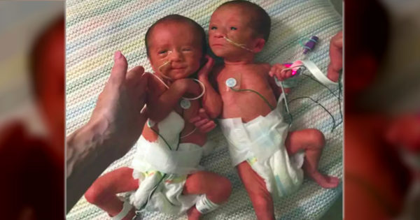 31 Week Babies Born No Bigger Than a Soda Bottle