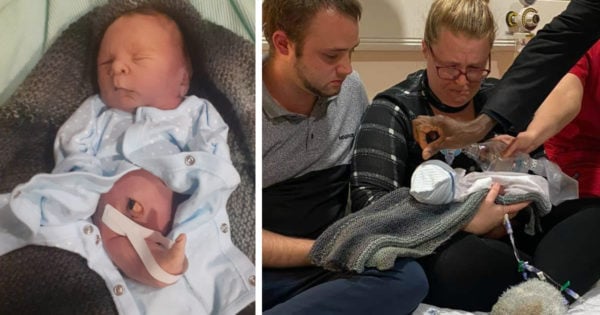 Baby Born With Mermaid Tail Lives 1 Day Then Dies In Dad's Arms