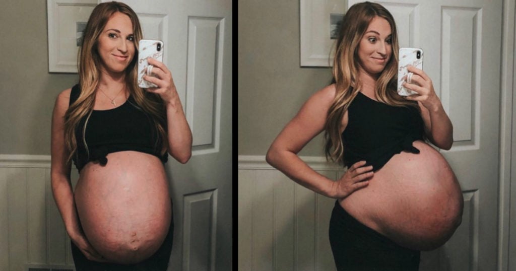 Mom Gives Birth To Quadruplets And Shares Before And After Photos