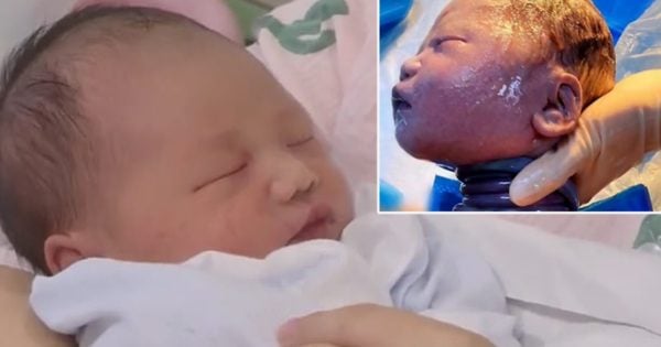 Umbilical Cord Wrapped Around Neck 6 Times But Baby Miraculously Ok   Godupdates Umbilical Cord Wrapped Around Neck 6 Times Fb 600x315 